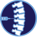 Rhizotomy